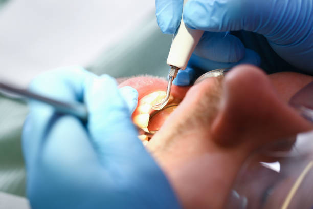Best Emergency Treatment for Toothache in Kinsey, AL