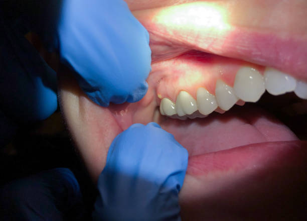 Best Emergency Treatment for Toothache in Kinsey, AL