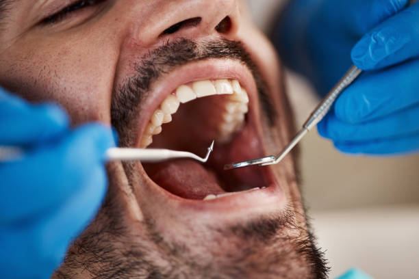 Best Emergency Wisdom Teeth Removal in Kinsey, AL
